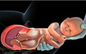 顺产侧切的好处和建议，孕妈需了解