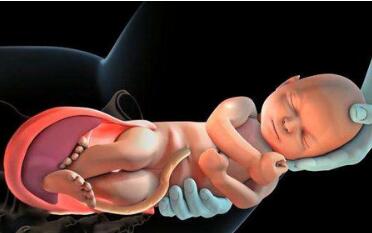 顺产侧切的好处和建议，孕妈需了解