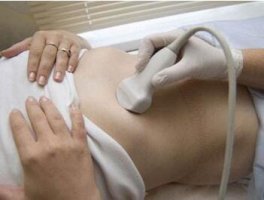 免疫性不孕检查