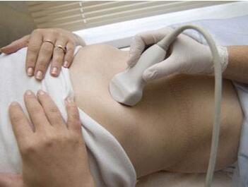 免疫性不孕检查