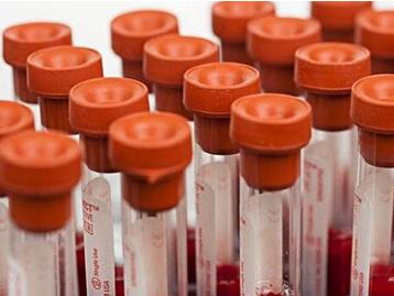 小儿苯丙酮尿症怎么治疗