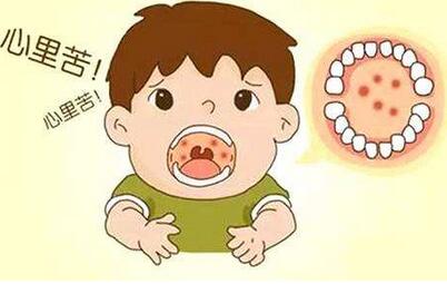 疱疹性咽峡炎是什么