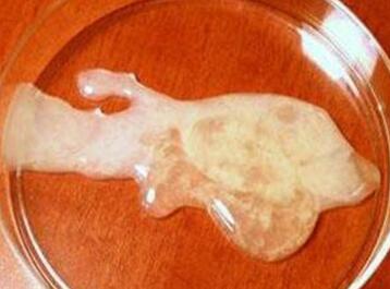 精液稠怎么回事？精液稠怎么办？