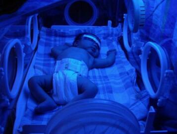 总胆红素偏高的原因_总胆红素偏高怎么办