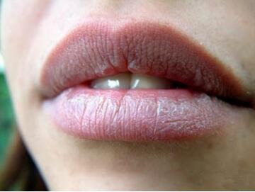嘴唇上有小白点颗粒状怎么回事？