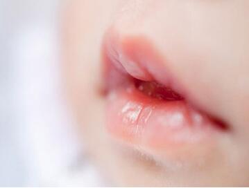 嘴唇上有小白点颗粒状怎么回事？