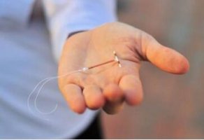 节育环怎么取？节育环可以终身不取吗？