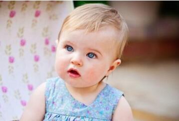 荷兰牛栏奶粉上火吗？宝宝吃奶粉上火怎么办？