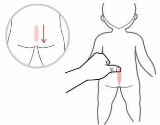 小儿秋季腹泻怎么治疗？宝宝秋季腹泻推拿手法治疗方法