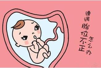 胎位臀位是什么意思？胎位臀位危害、怎么纠正