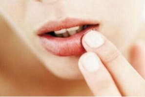嘴巴上火起泡怎么办 孕妇上火吃什么水果好