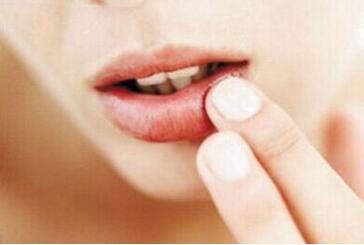 嘴巴上火起泡怎么办 孕妇上火吃什么水果好