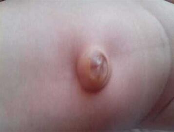 新生儿肚脐护理可以用双氧水消毒吗