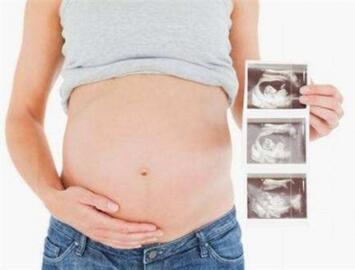 唐氏胎儿在母体的症状有哪些