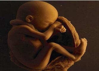 脐带过短的定义