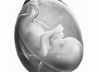 脐带过短的定义