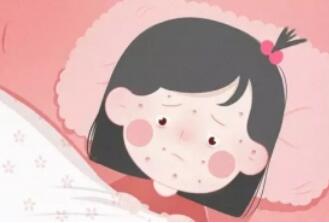 小孩长水痘第几天最严重几天能好？出水痘要注意什么