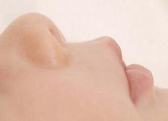 宝宝鼻塞怎么办