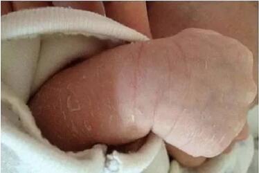 宝宝常见10大皮肤问题及护理心得