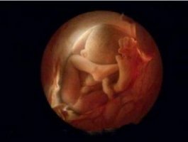 怀孕7个月胎儿图及注意事项