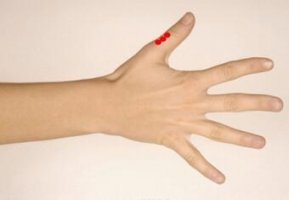 快速催经方法当天见效 如何让月经提前只需这两