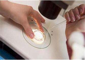 男性备孕前检查项目及费用 注意事项