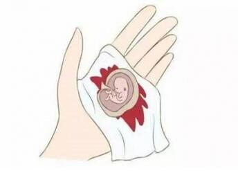 药流的最佳时间是几周 药流后注意事项