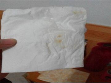 排卵期有什么症状