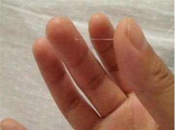 排卵期有什么症状