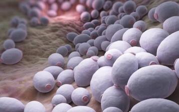 鹅口疮怎么治疗