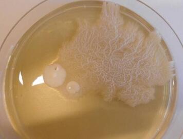 婴儿鹅口疮症状有哪些