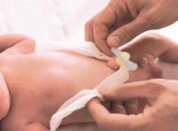 新生儿肚脐出血是怎么回事