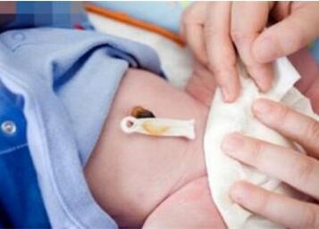 新生儿肚脐出血是怎么回事