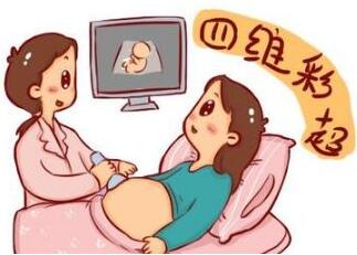 四维彩超检查什么