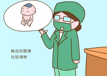 四维彩超报告单怎么看