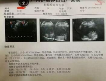 人流后多久可以怀孕