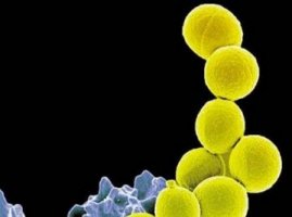 新生儿脓疱疮病是怎么引起的