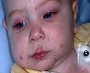 宝宝水土不服怎么办