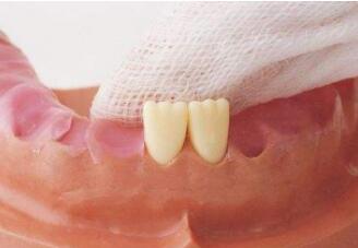 儿童乳牙有几颗