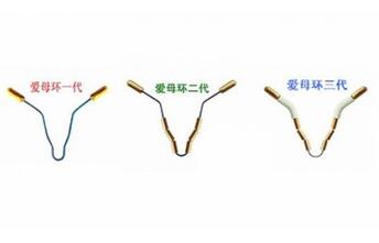 节育环的种类有几种