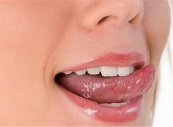 烂嘴角是怎么回事 什么原因