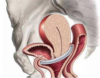 子宫后位如何受孕