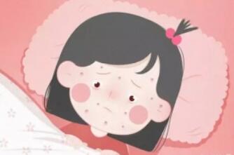 水痘传染吗 传染期是几天