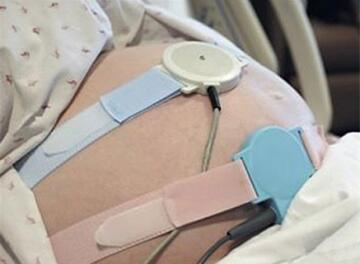 胎心监护nst是什么意思