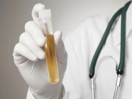 女性尿黄是怀孕了吗 怀孕了尿液会发黄吗