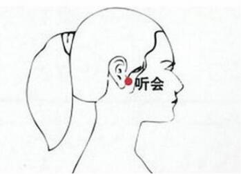 孕妇耳鸣怎么办小妙招