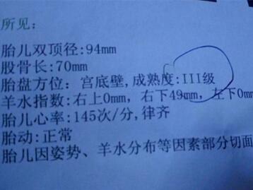 羊水指数四个值怎么看