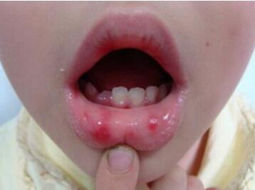 维生素b6对宝宝的作用及功能