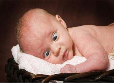 佝偻病的早期症状图片