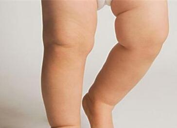 佝偻病的早期症状图片